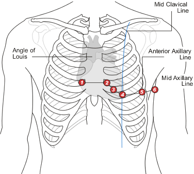 <p>left of sternum at 4th intercostal space</p><p></p>