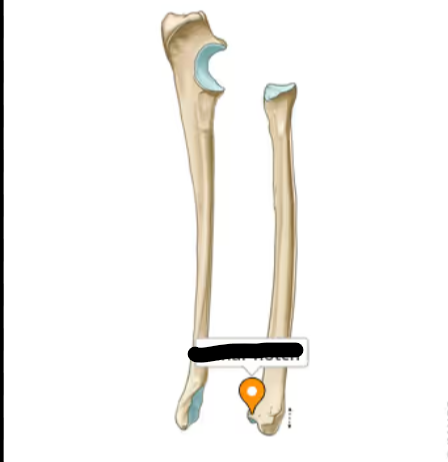 <p>What bone landmark is this within the <strong>Radius </strong></p><ul><li><p>(Lateral Forearm Bone, <strong>Antebrachial / Radial Region)</strong></p></li></ul><p></p>