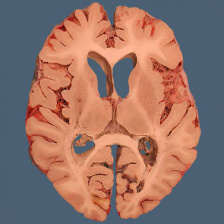 <p>label insular cortex, importance</p>