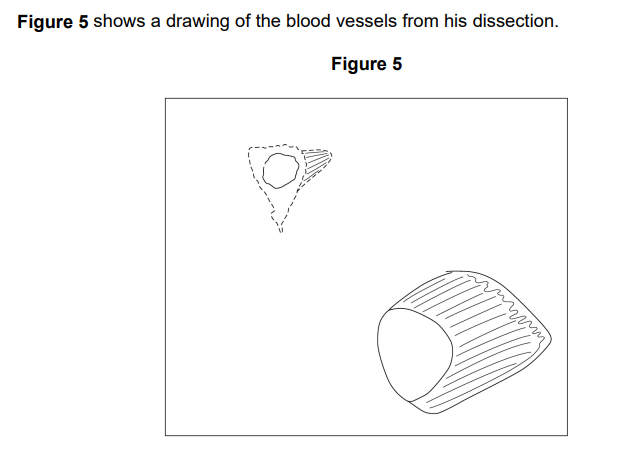 <p>Suggest two ways the student could improve the quality of his scientific drawing of the blood vessels in this dissection. (2 marks)</p>