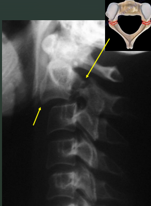 <p>Hangman’s Fx</p>