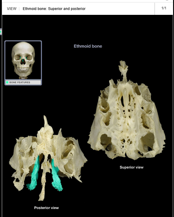 <p>Middle nasal concha</p>