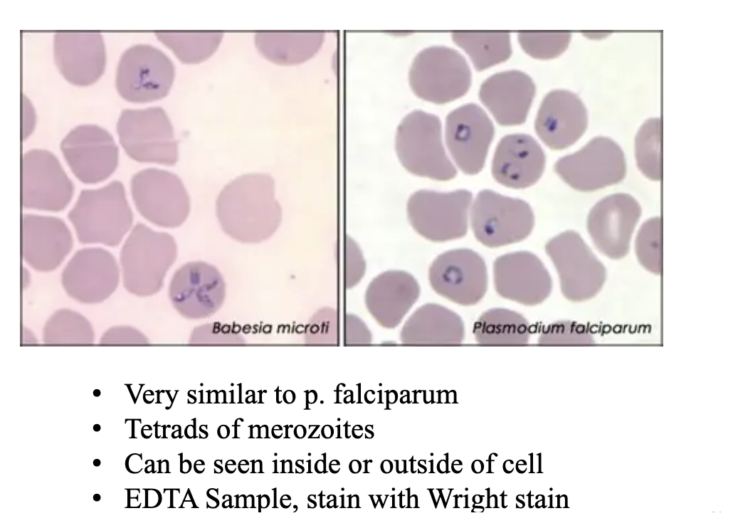 <p>What lab findings indicate <strong>Babesia?</strong></p>