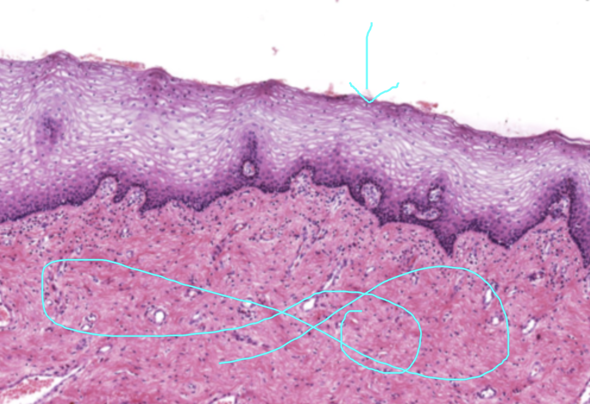 <p>identify the mucosa</p>