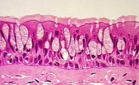 <p>Identify the epithelium</p><p>a. simple columnar epithelium</p><p>b. simple squamous epithelium</p><p>c. stratified squamous epithelium</p><p>d. pseudostratified columnar epithelium</p><p>e. simple cuboidal epithelium</p>
