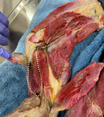 <p>Identify the muscle</p>