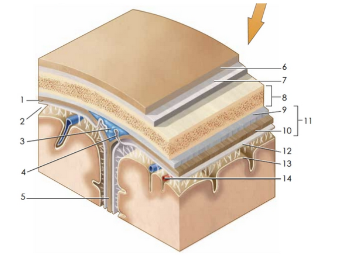 term image