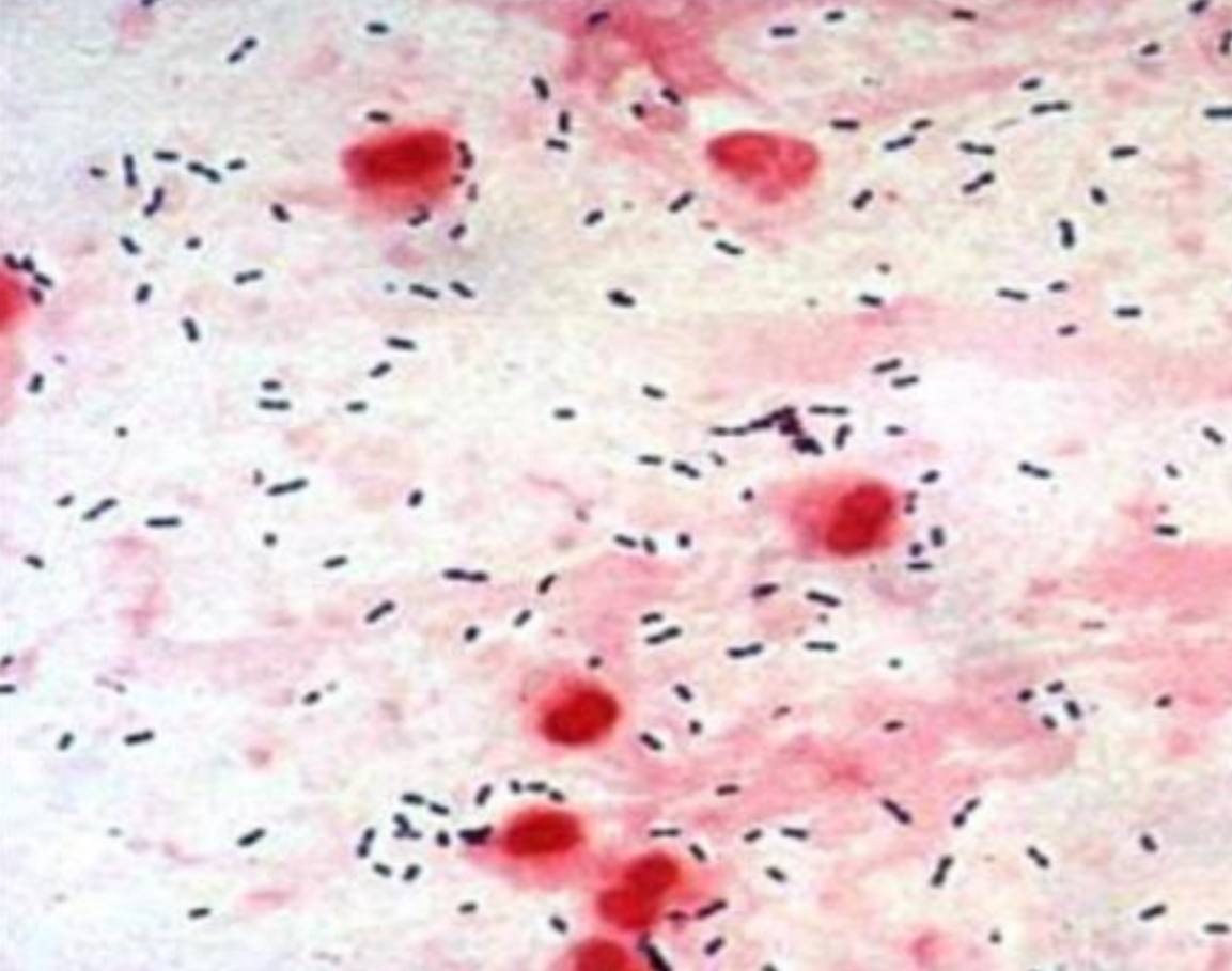 <p>Specimen (microscopically slide):</p><p>• Name of organism:</p><p>• Stain:</p><p>• Sample from: culture or pus or in tissue</p><p>• Morphology</p>