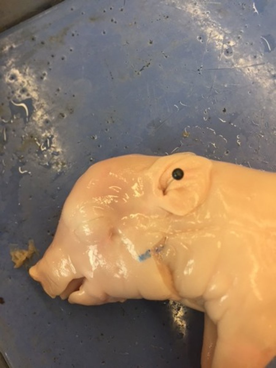<p>ear hole</p>