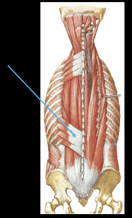 <p>what muscle?</p>
