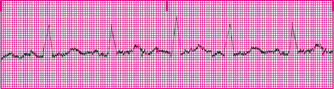 <p>What rhythm is this?</p>
