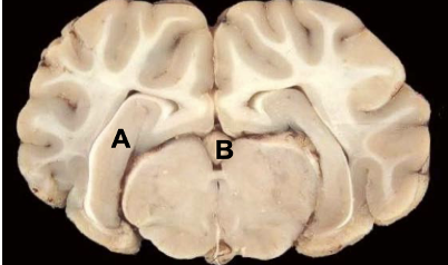 <p>A</p>
