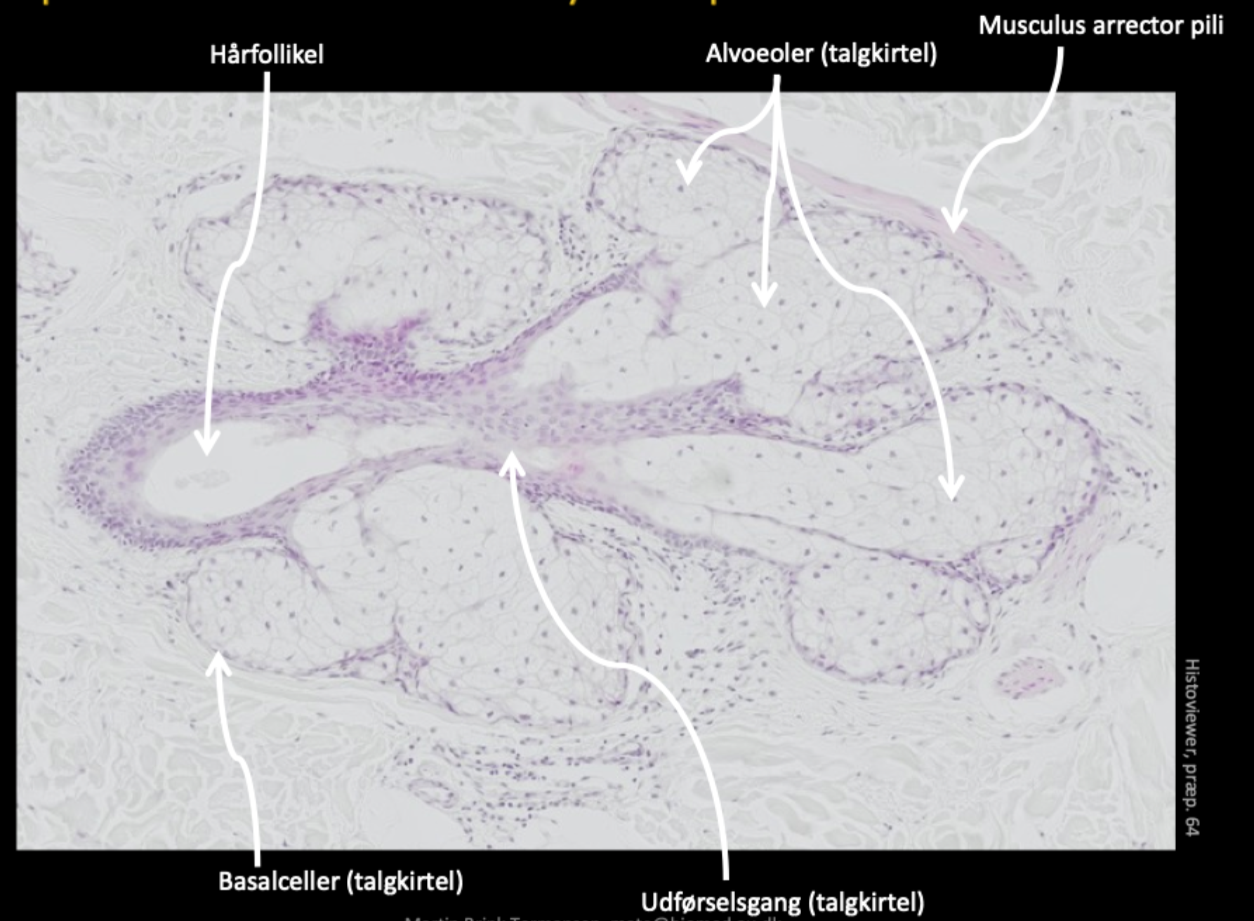 <p>1, Hårfolikel<br>2. Alvoeoler (talgkirtel)<br>3. Musculus arrector pili<br>4. Udførelsesgang (talgkirtel)<br>5. Basalceller (talgkirtel)</p>
