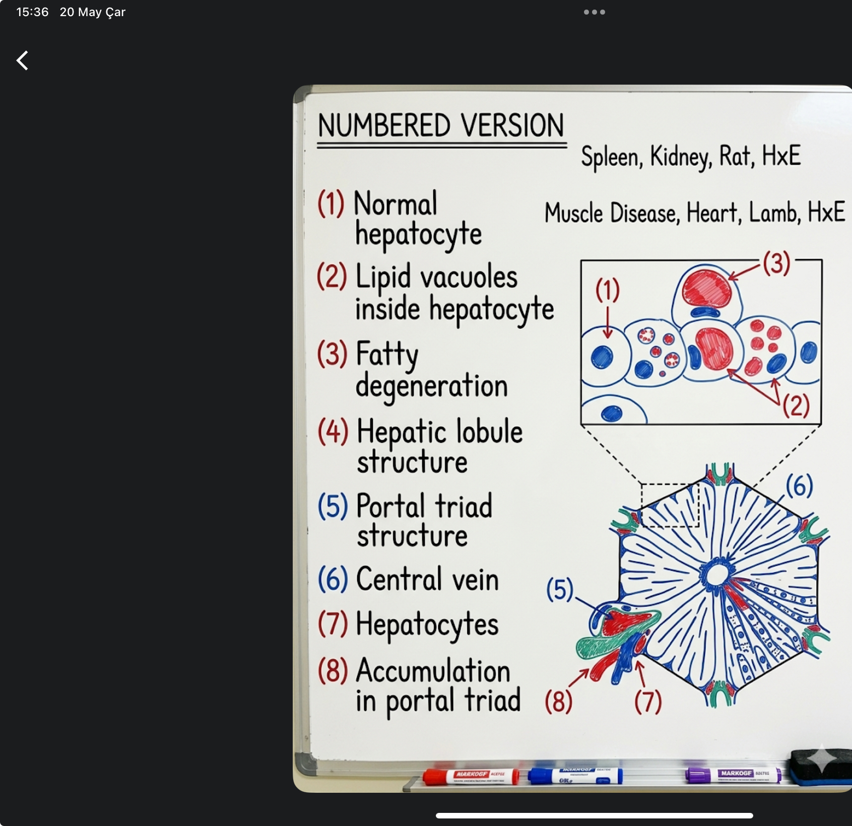 <p>diffuse lipidosis, liver</p>