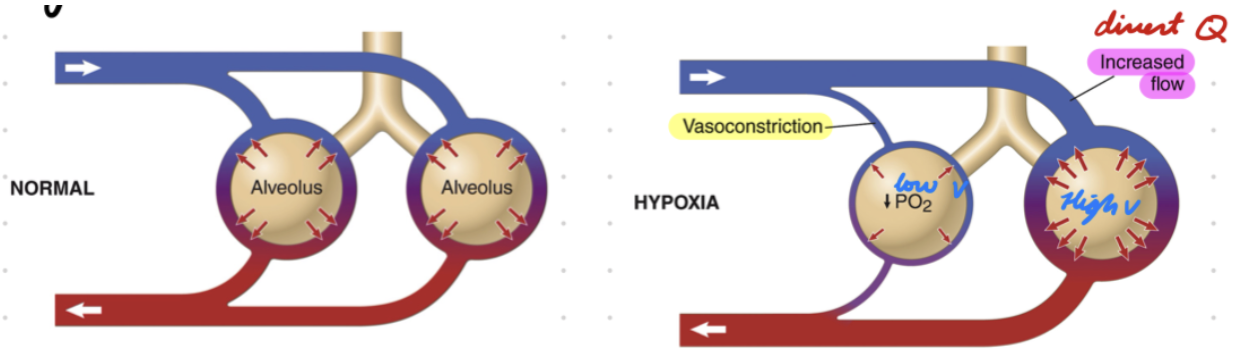 <p>Low PO2 (ventilation) = Alveolar vasoconstriction</p><ul><li><p>Divert blood flow (Q) to well-ventilated (V) alveoli</p></li></ul><p></p>