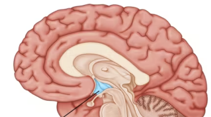 term image