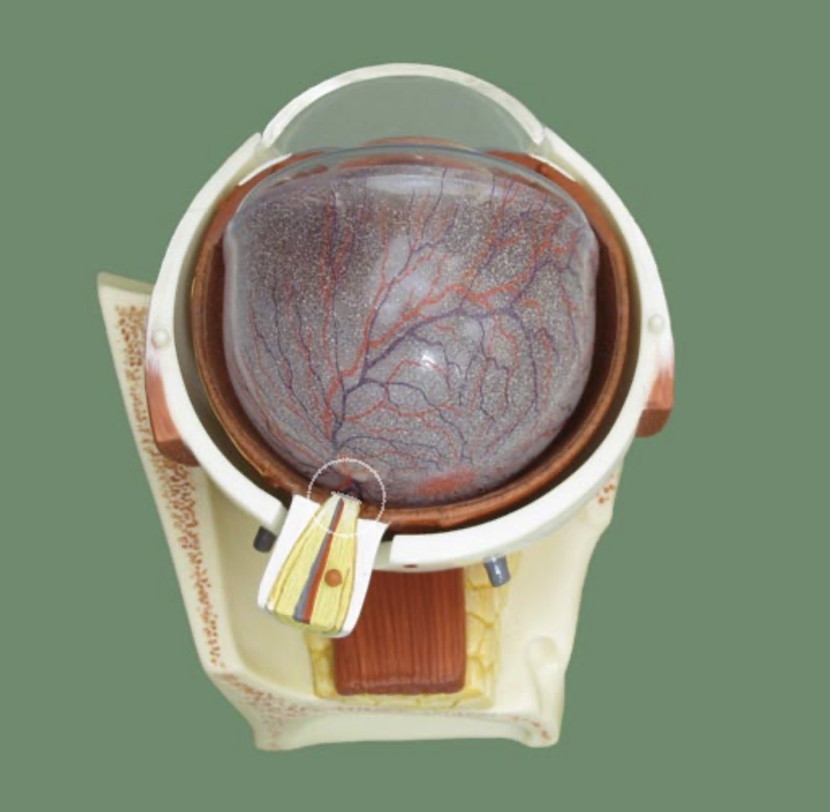 <p>where the optic nerve exits, lacks photoreceptors</p>