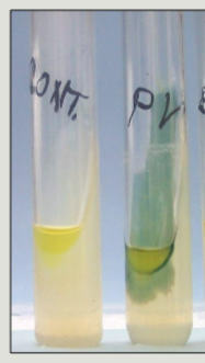 <p>phenylalanine deaminase present → PPA present → FeCl<sub>3</sub> reacts and appears deep green</p><p>(PP in the pool turns green)</p>