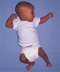 <p>20 weeks gestation</p>