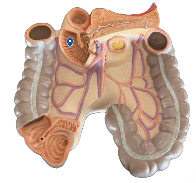 <p>Name this segment of the small intestine.</p>