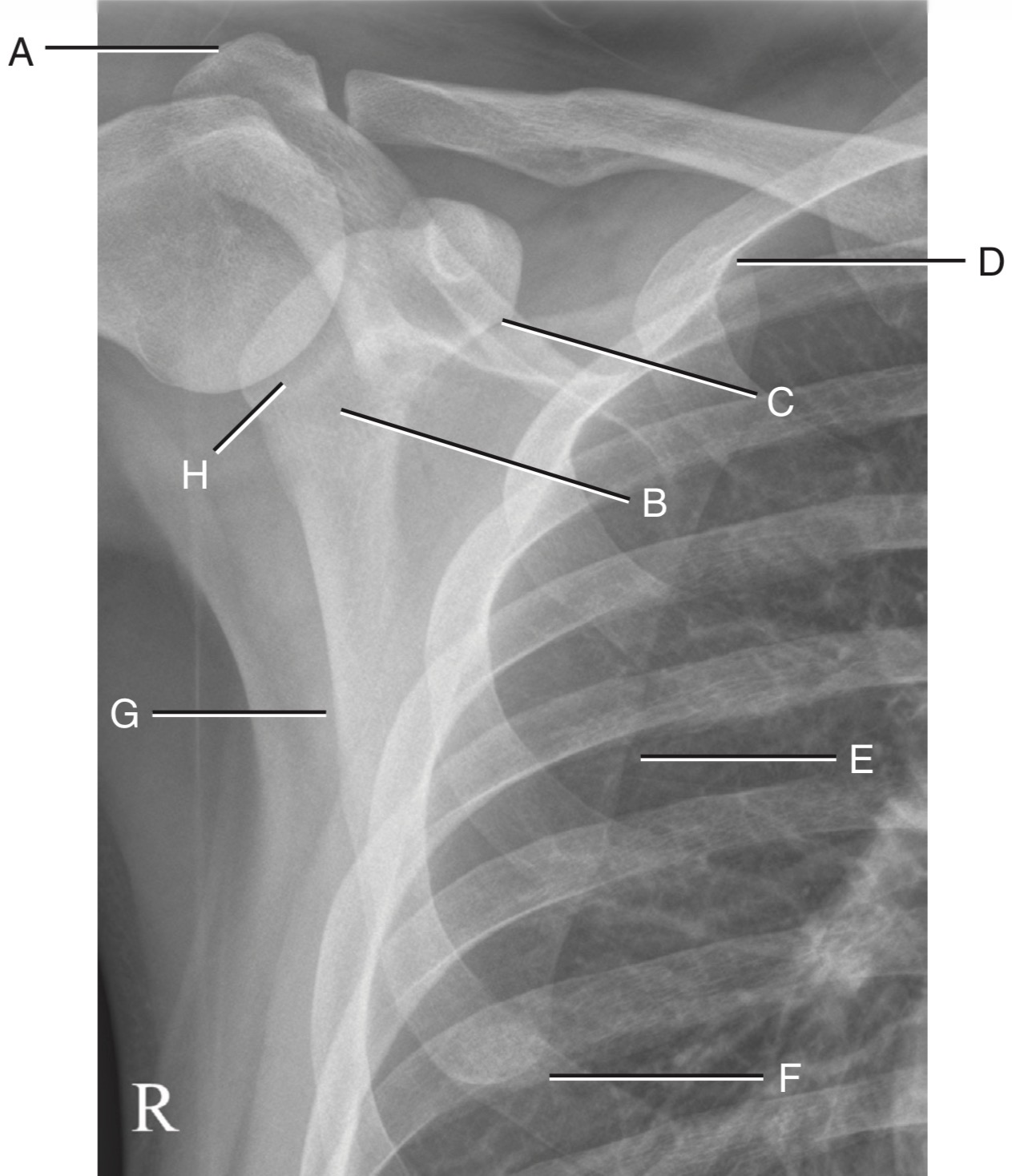 <p>A</p>