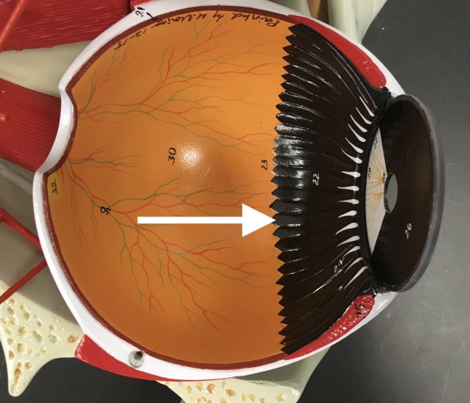 <p><span>name the jagged edge structure at the end of the arrow's point</span></p>