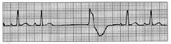 <p>Which rhythm is this?</p>