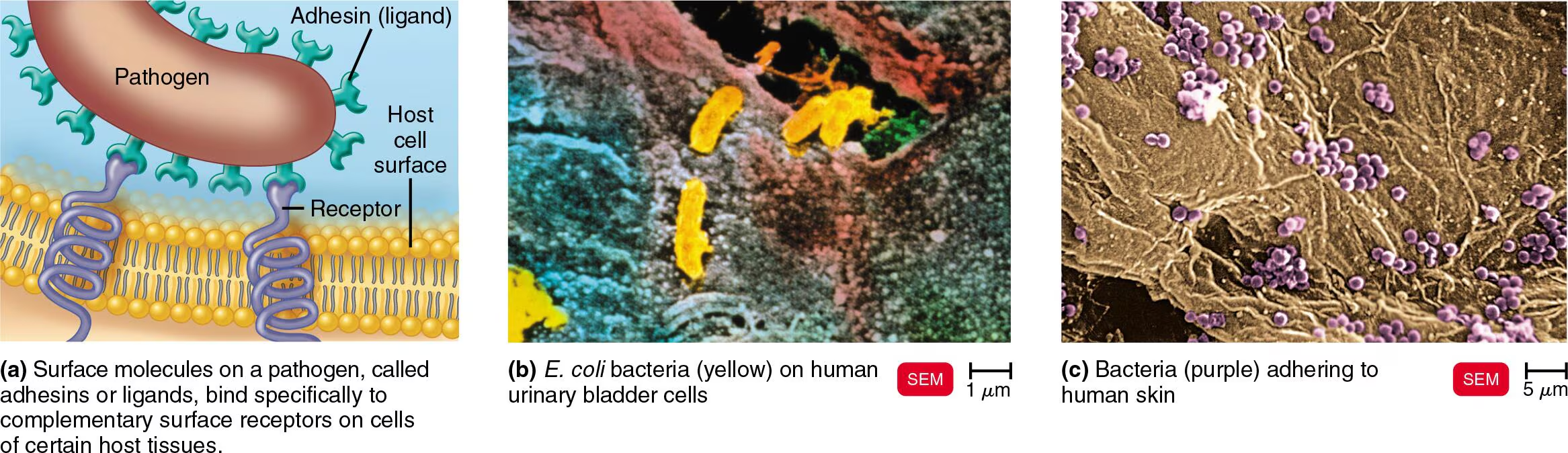 <p>To understand how microbes cause disease<br><br></p><p><span style="color: yellow;">Adherence (Adhesion)</span></p><ul><li><p>Microorganisms attach to surfaces, such as host tissues, using specialized molecules called <strong>adhesins</strong></p></li></ul><ul><li><p>Attachment phase and is a necessary step for most pathogens to become harmful</p></li><li><p>Lock (body cells) &amp; Key (pathogen) system<br><br></p></li></ul><p><span style="color: yellow;">Mechanism: Adhesins &amp; Receptors</span></p><ul><li><p>Microbes physically bind to nearby cells using specific molecules</p><ul><li><p><u>Adhesins (Ligands)</u>: These are surface molecules on the <strong>pathogen</strong></p><ul><li><p>Usually made of glycoproteins or lipoproteins</p></li></ul></li><li><p><u>Receptors</u>: These are complementary surface molecules on the <strong>host cell</strong></p><ul><li><p>Typically sugars, like mannose<br><br></p></li></ul></li></ul></li></ul><p><span style="color: yellow;">Examples of Adherence in Action</span></p><ul><li><p><u>Dental Plaque (Streptococcus mutans)</u></p><ul><li><p>This bacterium uses an enzyme to turn glucose into a sticky substance called <strong>dextran</strong></p></li><li><p>This forms a “sticky net” — glycocalyx, which allows the bacteria to cling to your teeth</p></li></ul></li><li><p><u>Respiratory Infections (Influenza &amp; COVID-19)</u></p><ul><li><p>Influenza: Uses a spike protein called <strong>HA </strong>to bind to sialic acid on your lung cells</p></li><li><p>COVID-19: Uses its famous <strong>S (spike) proteins</strong> to attach to a specific receptor called <strong>ACE2</strong> on human cells<br><br></p></li></ul></li></ul><p>Overall, this is an important concept because if we can figure out how to <strong>alter or block</strong> either the adhesin or the receptor, then we can prevent the infection from ever starting</p>