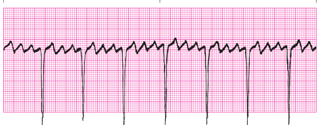 <ol><li><p>Regularity?</p></li><li><p>Rate</p></li><li><p>P Waves</p></li><li><p>PRI</p></li><li><p>QRS</p></li><li><p>Interpretation</p></li></ol><p></p>