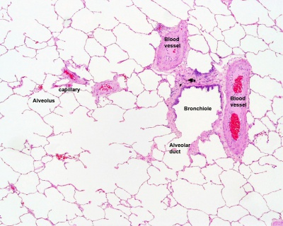 <p>Bronchus has cartilage and much larger than bronchiole</p>