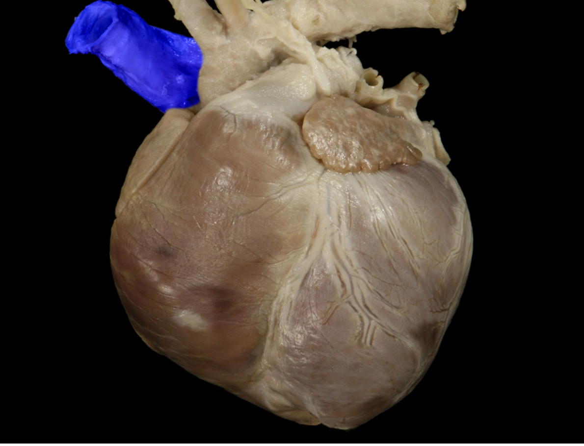 <p>name the structure </p>