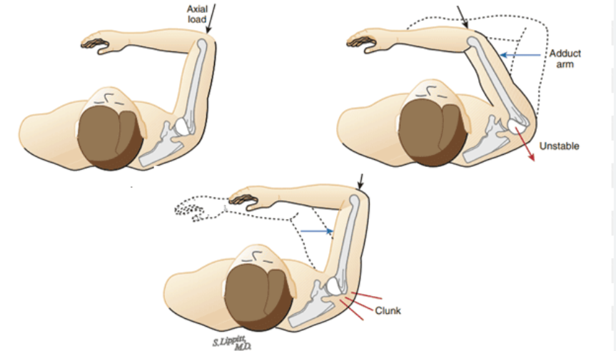 <p><strong>glenohumeral instability</strong></p><p><span style="background-color: transparent;">have patent sitting</span></p><p>grab shoulder with fingers on collarbone (to stablize)</p><p>bring their arm bent with hand facing ground (robot)</p><p>push arm into socet from elbow</p><p>keep the compresstion and bring elbow infront of them</p><p><span style="background-color: transparent;">positive if: click or clunk or repoduction of symptopms</span></p>
