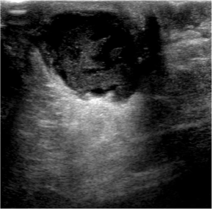 <p>What is this image demonstrating?</p>