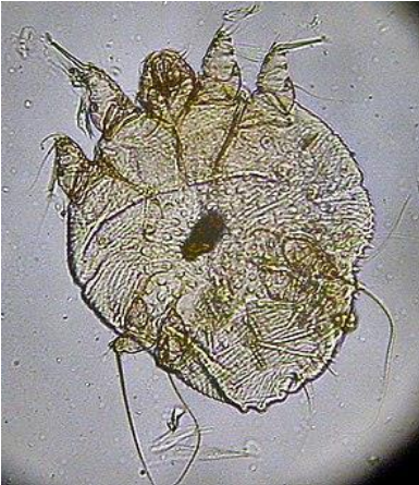 <p>Identifique o artrópode e cite o tratamento da doença</p>