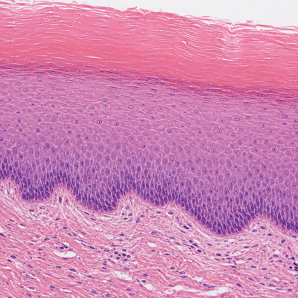 <p>What type of Epithelial Tissue is this?</p>