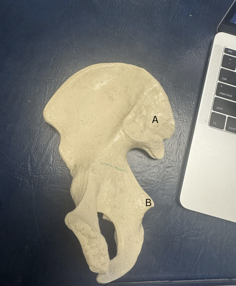 <p>Label these two structures</p>