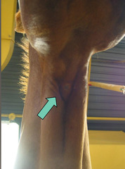 <p>What post-op presentation is this? What did it fix?</p>