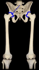 <p>Definition: The joint where the femur (thigh bone) connects with the pelvis, allowing the leg to move in many directions.</p><p>(1) Articulating Bones: </p><p> - Hip bone and femur</p><p>(2) Structural Type: </p><p> - Synovial; ball-and-socket</p><p>(3) Functional Type & Movements Allowed:</p><p> - Diarthrotic; multiaxial; flexion, extension, abduction, adduction, rotation, circumduction of thigh</p>