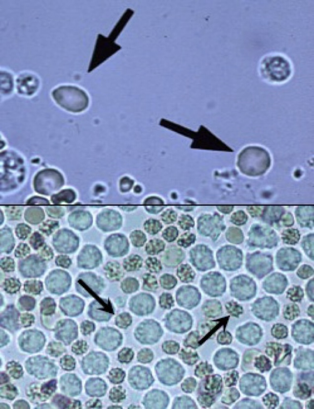 <ul><li><p>In fresh urine, they’re small, round, usually smooth edged, biconcave disc shaped.</p></li><li><p>Somewhat refractile.</p></li><li><p>Orange or yellow in color, some may be colorless.</p></li><li><p>In concentrated urine, they shrink and crenate.</p></li><li><p>In dilute or alkaline urine, they swell and may lyse.</p></li></ul><p></p>