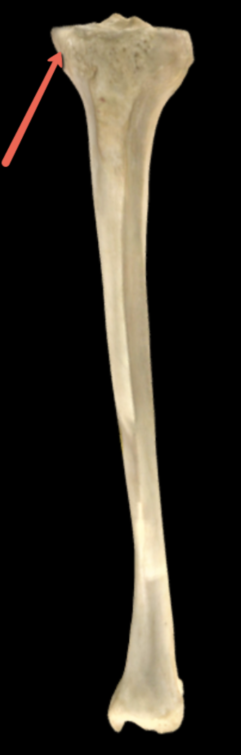 <p><strong>Identify the bone marking indicated by the pointer.</strong></p>