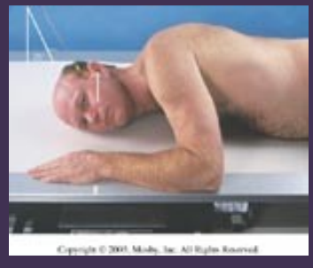 <p>collim of AXIOLAT (SCHULLER) — <strong>TMJ</strong></p>