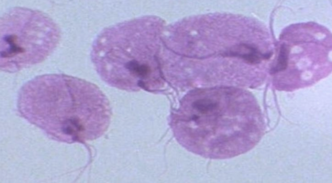 <p>What protist is this?</p>