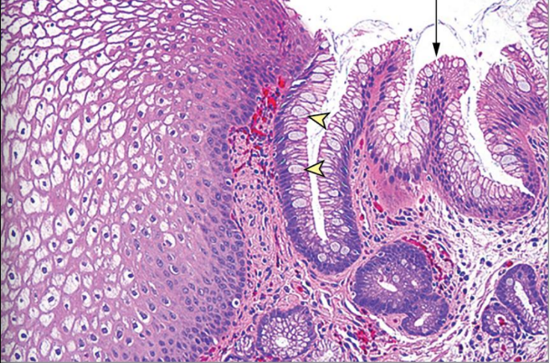 <p>What is abnormal in this image</p>