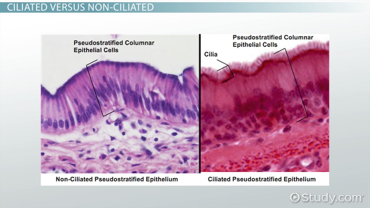 <p>Respiratory epithelium, appear stratified but are all in contact with basal lamina</p>