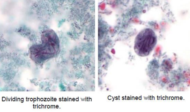 <p>Trophozoite: Pear shaped organism with tail</p><p>Cyst: 2 nuclei (immature)'; 4 nuclei (mature)</p>