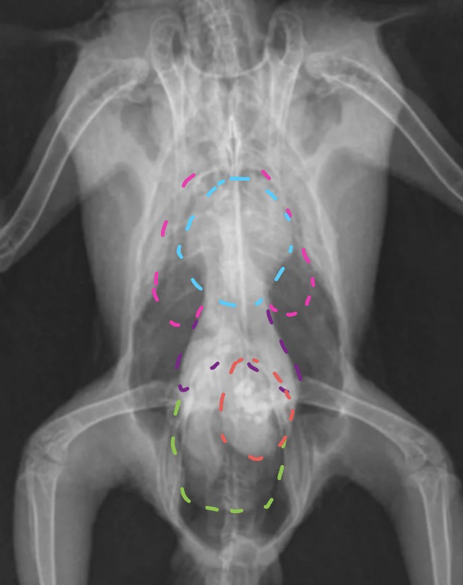 <p>What are the purple indented lines illustrating? </p>