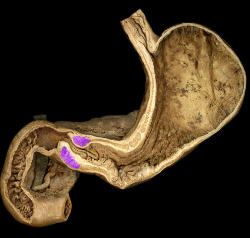 <p>thick ring of smooth muscle in the pyloric orifice </p>