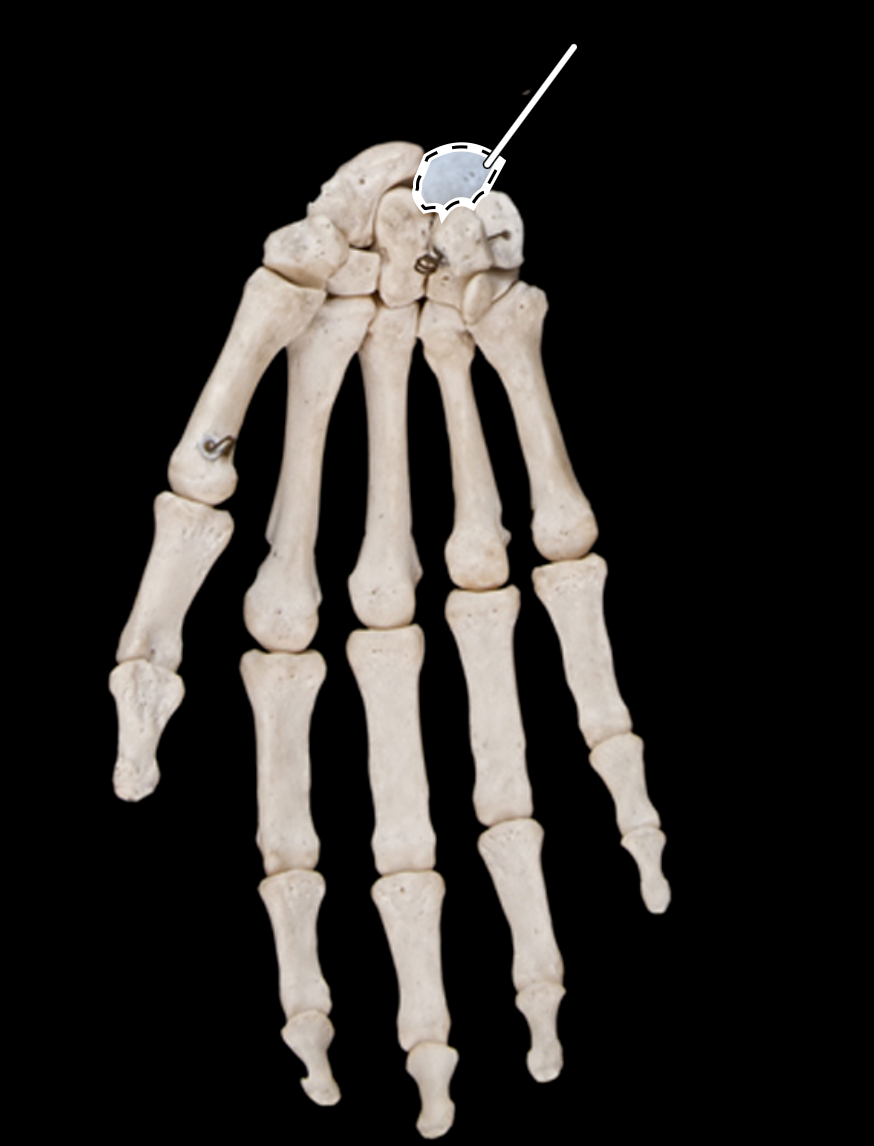 <p>anterior view</p>