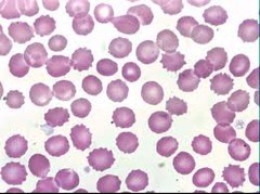 <p>What mammal likely has these as their normal red blood cells?</p>