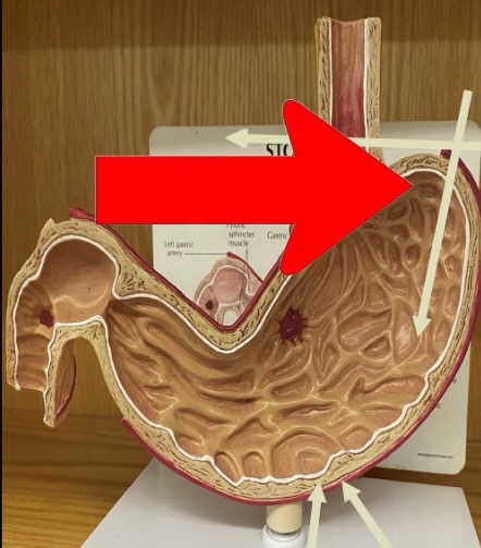 term image